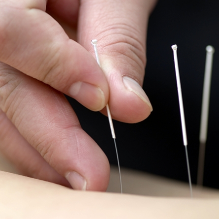 Profesionales de la medicina de acupuntura