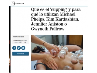 Qué es el 'cupping' y para qué lo utilizan Michael Phelps, Kim Kardashian...