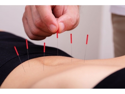 Acupuntura en neoplasias hematológicas y trasplante de células