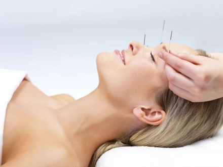 Acupuntura ocular para pacientes con insomnio.