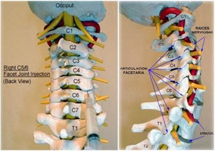 BENEFICIOS DE LA ACUPUNTURA COLUMNA CERVICAL