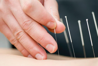 ¿COMO AYUDA LA ACUPUNTURA A CONTROLAR EL DOLOR CRONICO ?