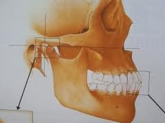 EJERCICIOS PARA RELAJAR LA MANDIBULA