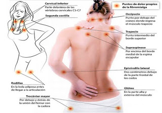 La medicina tradicional china y fibromialgia