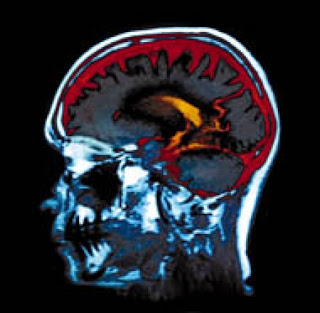 LOS CIRCUITOS CEREBRALES DE LOS AUTISTAS SON DISTINTOS, SEGUN UN ESTUDIO