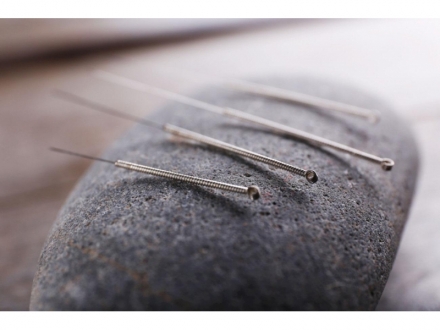 Manejo del dolor con Acupuntura