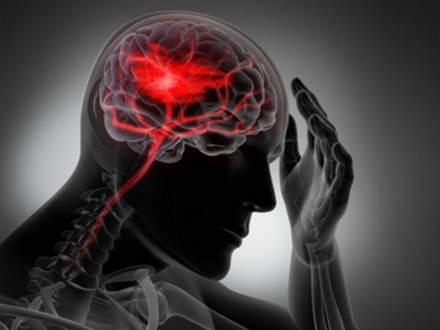 Medicina manipulativa osteopática en el tratamiento de los dolores de cabeza