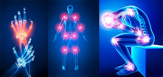 PLANTAS PARA LA SALUD ARTICULAR