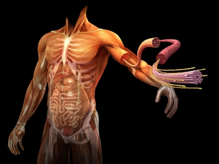 ¿Qué es el Síndrome Compartimental?