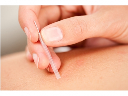 ¿Qué son los Trigger Points?