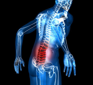 TRATAMIENTO NATURAL PARA LA LUMBALGIA: 3 CONSEJOS BASICOS